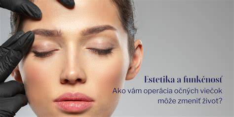 Estetika a funkčnosť fasádnych omietok