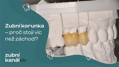 Schéma zirkónovej korunky na zube