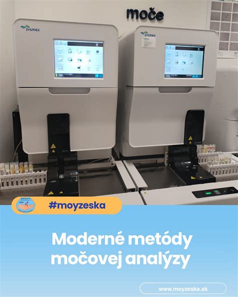 Moderné metódy ošetrovania diabetických rán