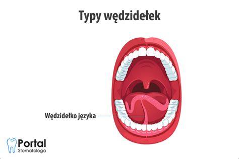 Typy pletacieho drôtu