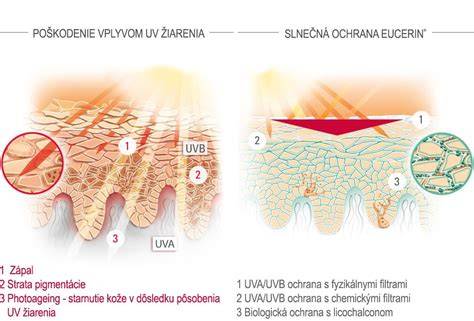 Detail lamelovej slnečnej ochrany