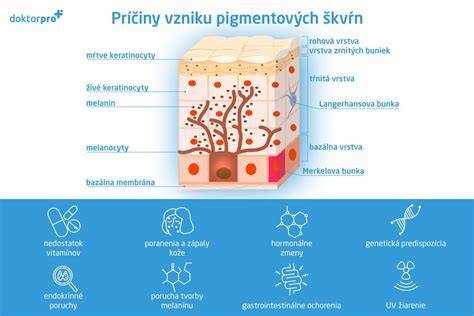 Príčiny praskania betónu: mráz, vlhkosť, vek, zlá zmes, sadanie pôdy