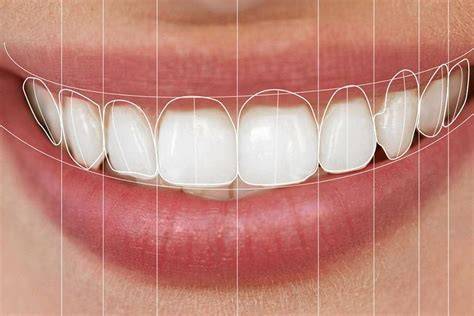 Digital Smile Design: Návrh úsmevu