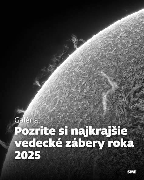 Mikroskopický záber izolovaných baktérií