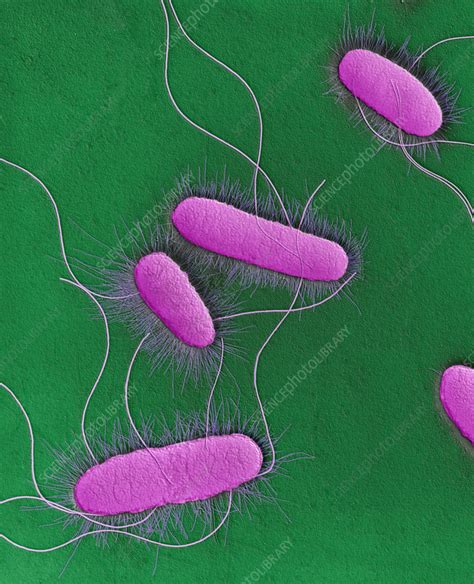 Vizualizácia narušenia bunkových stien E. coli ultrazvukom