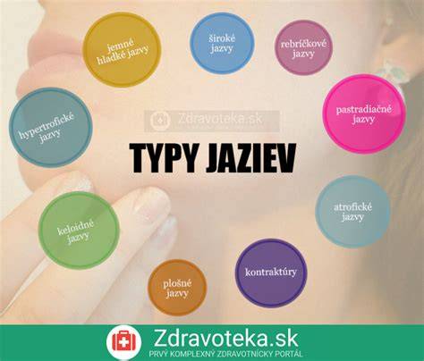 Infografika - prehľad zákazníckych recenzií