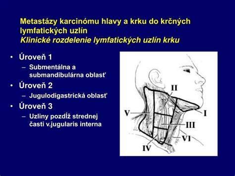 Mapa lymfatických uzlín na krku