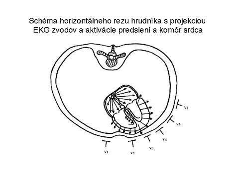 schéma rezu cyklotrasy s gabiónovými múrmi