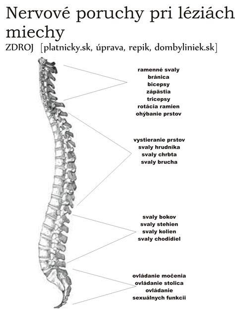 Ilustrácia chrbtice s vyznačenými platničkami a nervami