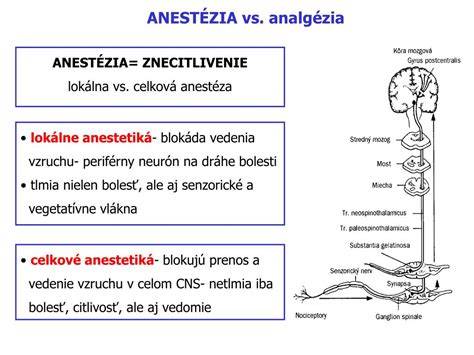 Diagram termoterapie (lokálna vs. celková, kontaktná vs. bezkontaktná)