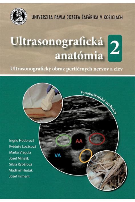 Anatómia univerzálneho skľučovadla